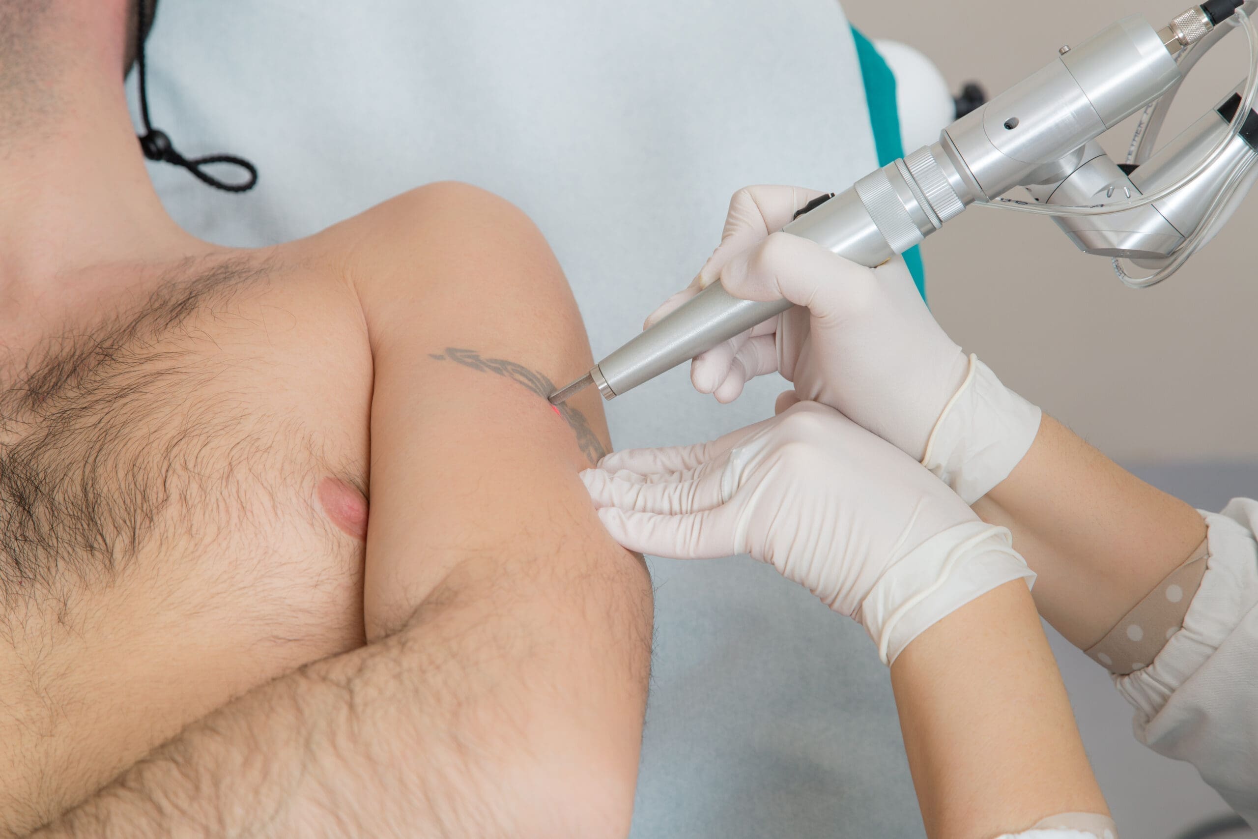 moderne tecnologie laser (Co2, NdYAG, Q-Switced, Alexandrite, etc…) per il trattamento di patologie ed inestetismi quali macchie cutanee, capillari, antiage, cicatrici di acne, rimozione tatuaggi e molto altro.